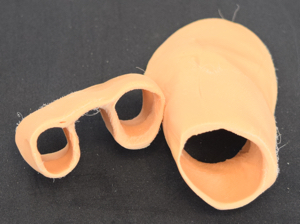 Ultrafijne orthoplastie